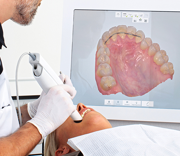 intra oral dental scanner 1