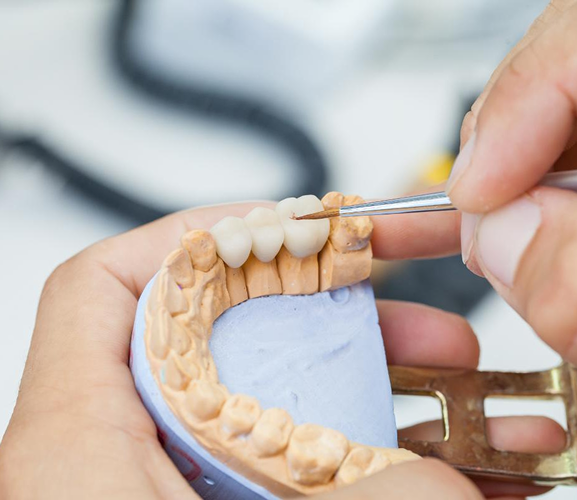 3-Tips-for-Choosing-The-Right-Dental-Crown-Material 1