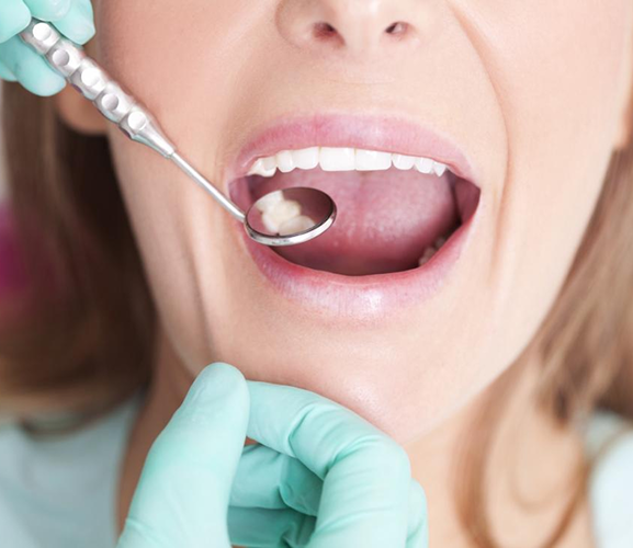 Dental-Article-2_2 1